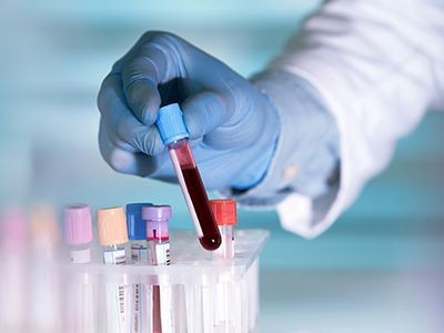 M R S LAB & ECG POOVATTUPARAMBA